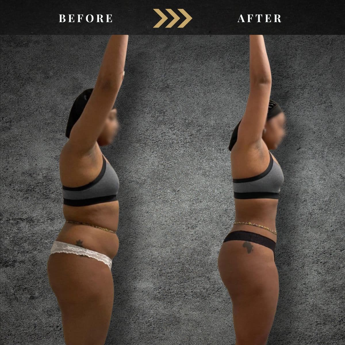A, before and after
